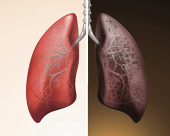 How lung cancer arises in non-smokers?